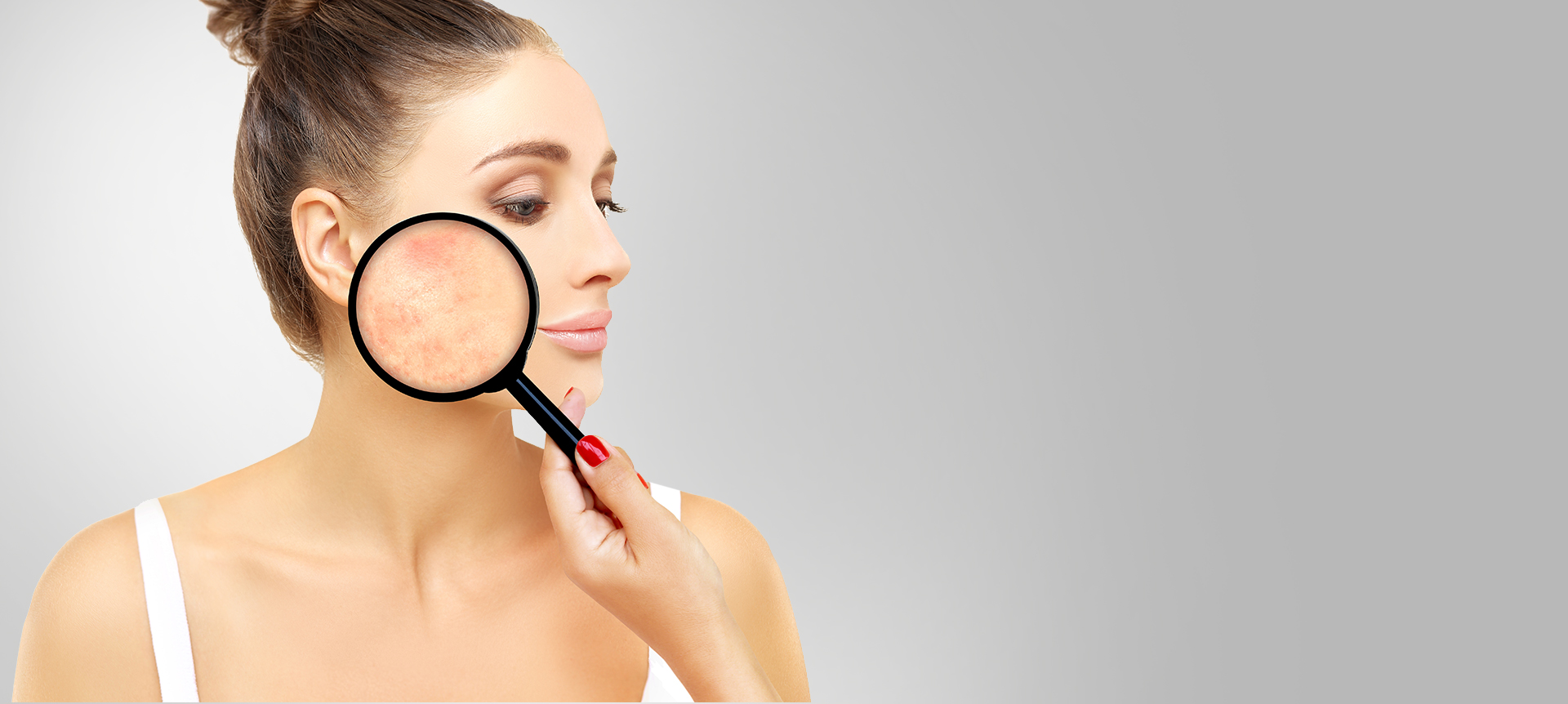 Третиране на розацея и лазерно подмладяване - Dias Dermatology